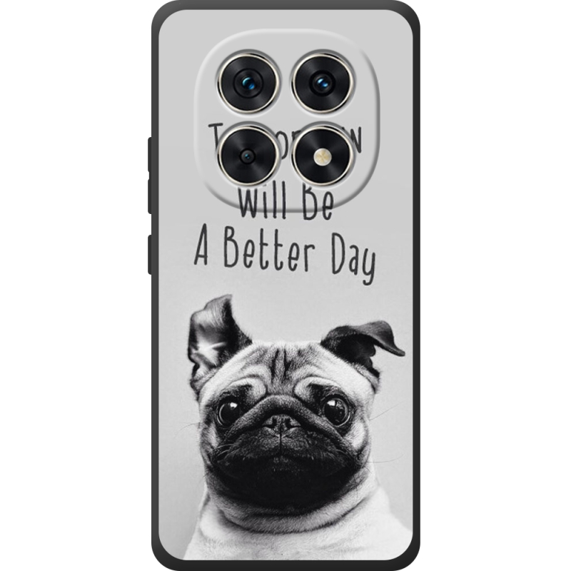 Чохол BoxFace Xiaomi Redmi Note 15 4G 