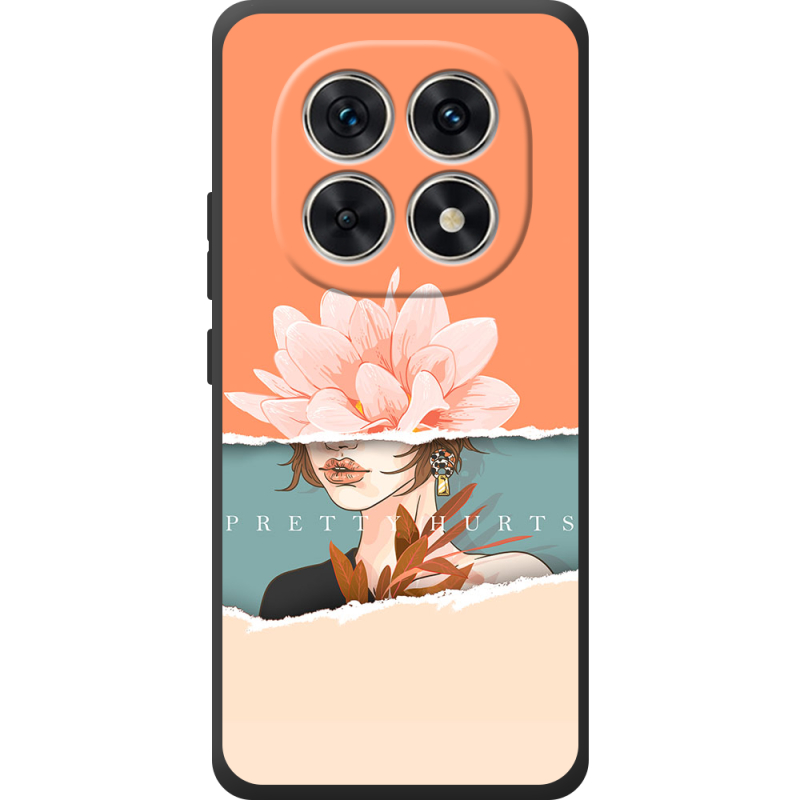 Чохол BoxFace Xiaomi Redmi Note 15 4G 