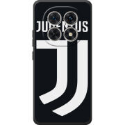 Чохол BoxFace Xiaomi Redmi Note 15 4G FC J