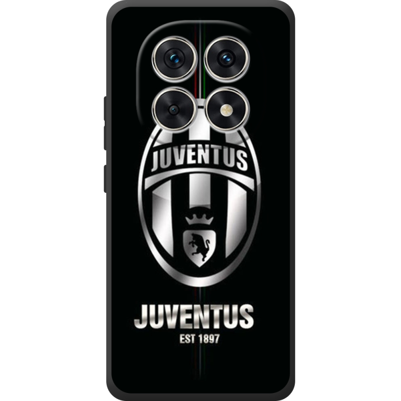 Чохол BoxFace Xiaomi Redmi Note 15 4G 