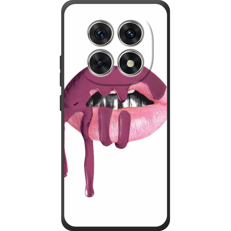 Чохол BoxFace Xiaomi Redmi Note 15 4G 