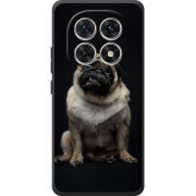 Чохол BoxFace Xiaomi Redmi Note 15 4G 