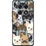 Чохол BoxFace Xiaomi Redmi Note 15 4G 