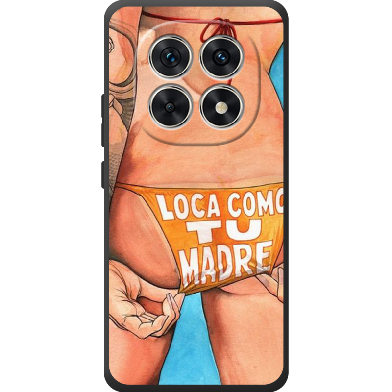 Чохол BoxFace Xiaomi Redmi Note 15 4G 