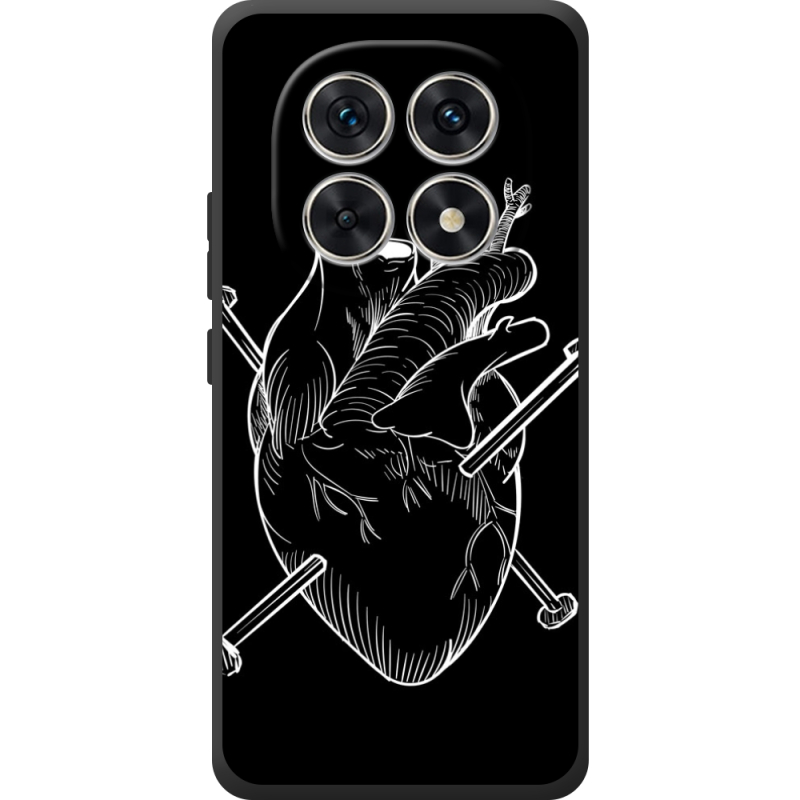 Чохол BoxFace Xiaomi Redmi Note 15 4G 