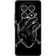 Чохол BoxFace Xiaomi Redmi Note 15 4G 