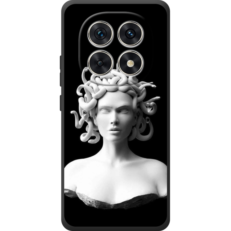 Чохол BoxFace Xiaomi Redmi Note 15 4G 