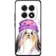 Чохол BoxFace Xiaomi Redmi Note 15 4G 