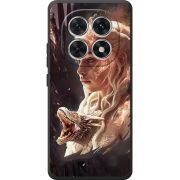 Чохол BoxFace Xiaomi Redmi Note 15 4G 