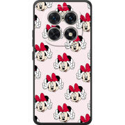 Чохол BoxFace Xiaomi Redmi Note 15 4G 