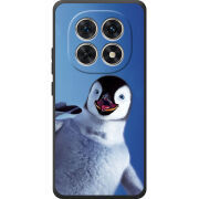 Чохол BoxFace Xiaomi Redmi Note 15 4G 