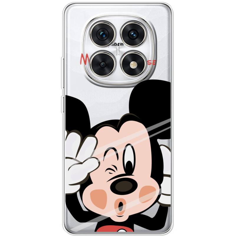 Прозорий чохол BoxFace Xiaomi Redmi Note 15 4G Mister M