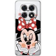 Прозорий чохол BoxFace Xiaomi Redmi Note 15 4G Lady M