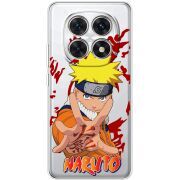 Прозорий чохол BoxFace Xiaomi Redmi Note 15 4G Naruto