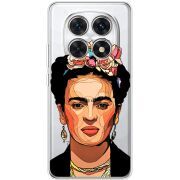 Прозорий чохол BoxFace Xiaomi Redmi Note 15 4G Фрида Кало