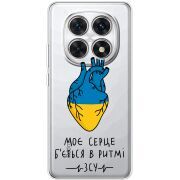 Прозорий чохол BoxFace Xiaomi Redmi Note 15 4G Моє серце в ритмі ЗСУ