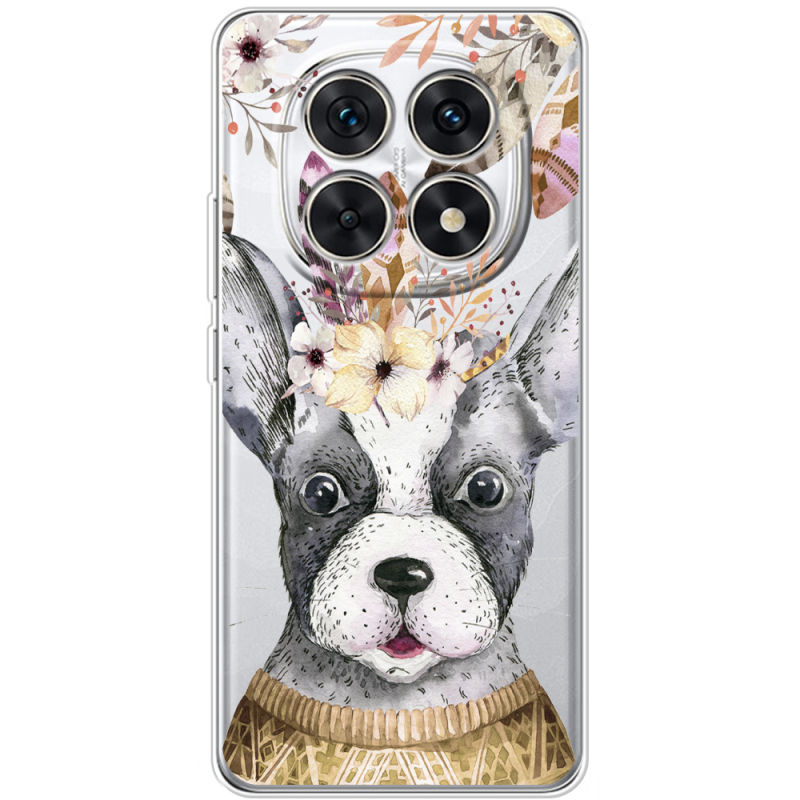 Прозорий чохол BoxFace Xiaomi Redmi Note 15 4G 