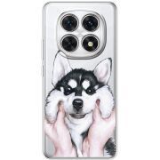 Прозорий чохол BoxFace Xiaomi Redmi Note 15 4G Husky