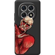 Чорний чохол BoxFace Xiaomi Redmi Note 15 4G Титан