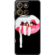 Чохол BoxFace Motorola G17 