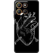 Чохол BoxFace Motorola G17 Power 