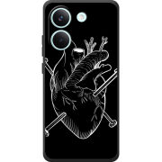 Чохол BoxFace Poco X8 Pro 