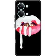 Чохол BoxFace Poco X8 Pro Max 