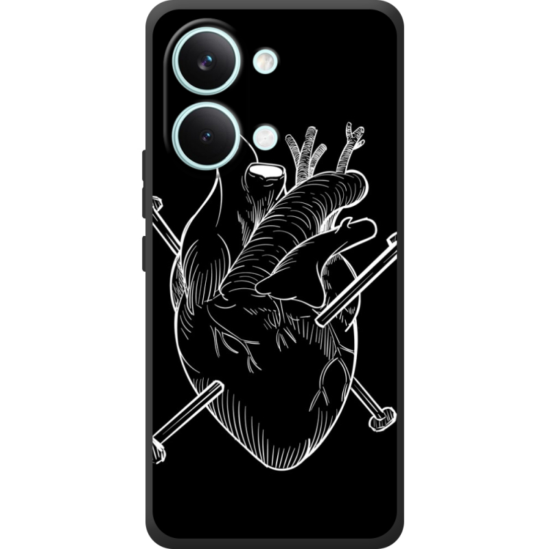 Чохол BoxFace Poco X8 Pro Max 