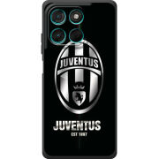 Чохол BoxFace Moto G77 