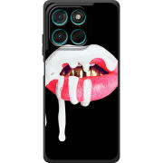 Чохол BoxFace Moto G77 