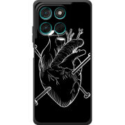 Чохол BoxFace Moto G77 