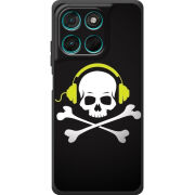 Чохол BoxFace Moto G77 