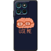 Чохол BoxFace Moto G77 