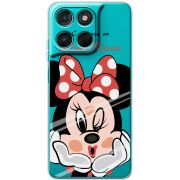 Прозорий чохол BoxFace Moto G77 Lady M