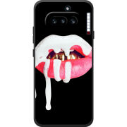Чохол BoxFace Nothing Phone (4a) 