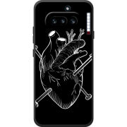 Чохол BoxFace Nothing Phone (4a) 