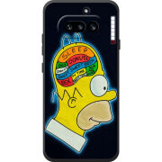 Чохол BoxFace Nothing Phone (4a) 