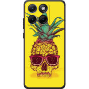 Чохол BoxFace Moto Edge 70 Fusion Pineapple Skull