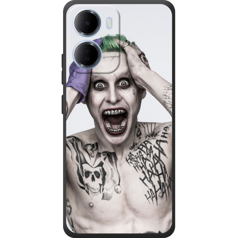 Чохол BoxFace Xiaomi Redmi 15A 