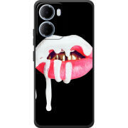 Чохол BoxFace Xiaomi Redmi 15A 