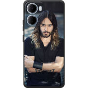 Чохол BoxFace Xiaomi Redmi 15A 