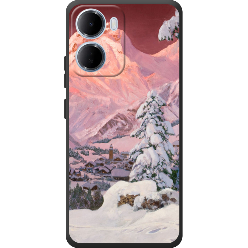 Чохол BoxFace Xiaomi Redmi 15A 