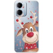 Прозорий чохол BoxFace Xiaomi Redmi 15A Winter Deer