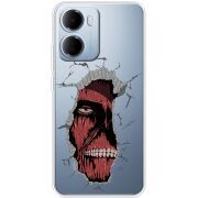 Прозорий чохол BoxFace Xiaomi Redmi 15A Нападение Титана