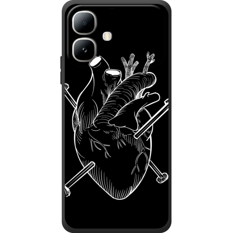 Чохол BoxFace Infinix Smart 20 