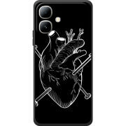 Чохол BoxFace Infinix Smart 20 