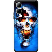 Чохол BoxFace Infinix Smart 20 