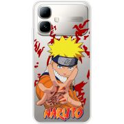Прозорий чохол BoxFace Infinix Smart 20 Naruto