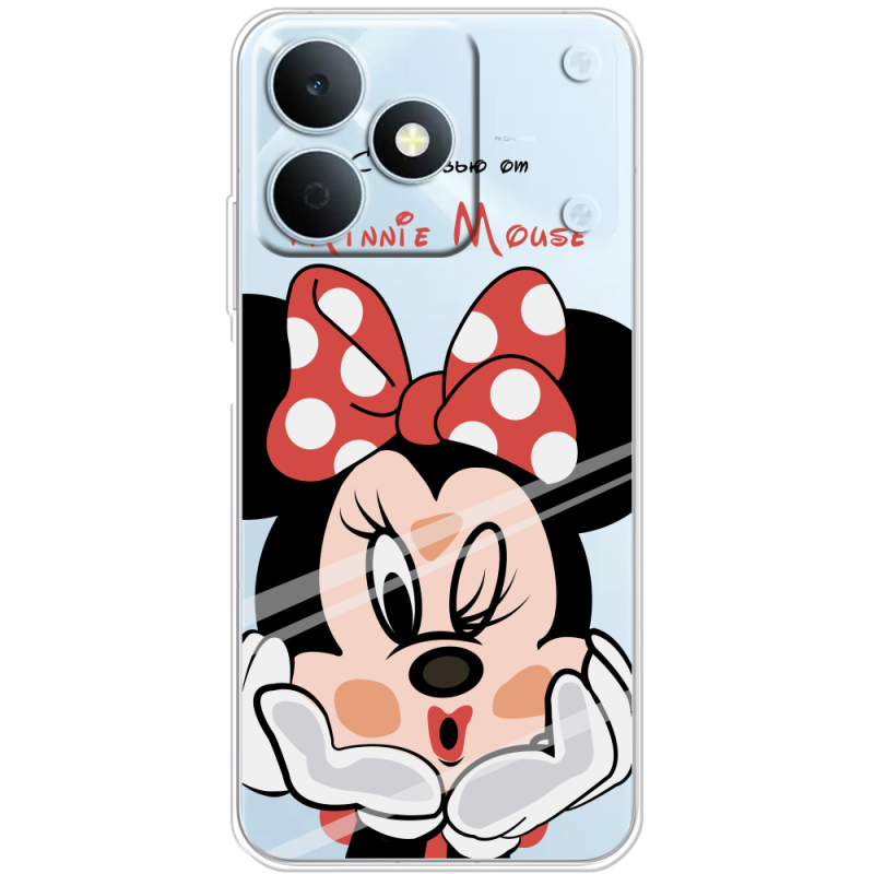 Прозорий чохол BoxFace Realme Note 80 Lady M