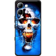 Чохол BoxFace Infinix Note Edge 